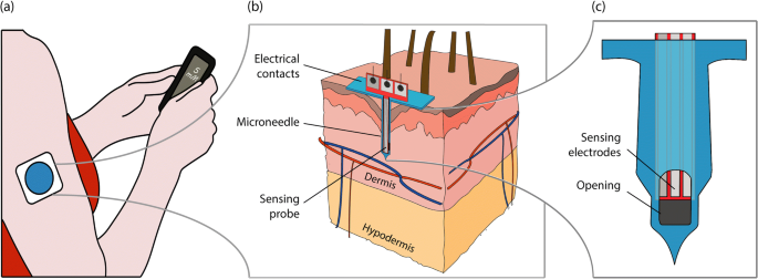Continuous Glucose Monitor wearable device